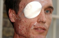 7/7 attack survivor blames emergency services for unnecessary suffering