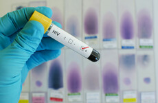 Increase in rate of HIV cases in Irish people aged over 50