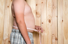 In 1975, one in every 100 Irish children was obese. Now, it's one in every 10