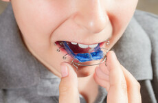 Over 200 children with serious teeth problems have waited over 4 years for treatment
