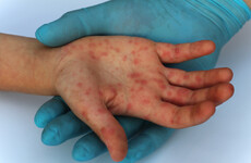 Parents urged to vaccinate children after HSE notified of potential measles case in Cork