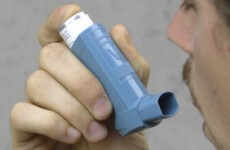 TCD research could lead to new treatment for asthma, dermatitis