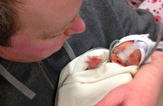 'Until you have a premature baby, you don't know what you're up against'