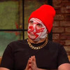 The Rubberbandits' Blindboy Boatclub brilliantly explained why he wears a plastic bag on his head