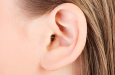 Why do your ears hang low? New research shows the answer to that question can be very complicated