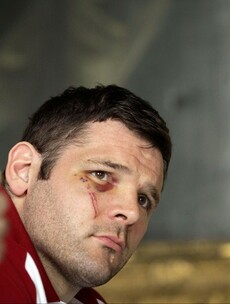 This is what your face looks like after you almost beat France in Paris…