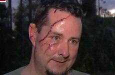 Man 'happy to be alive' after bear attacked him while he was letting dog out of house