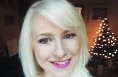 Life with albinism: 'Being shouted at, laughed at and pointed at regularly'