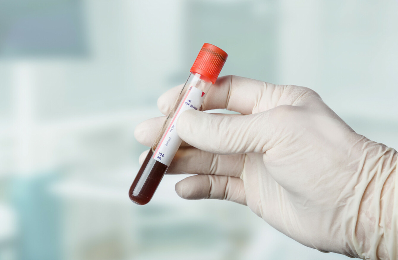 xfp test blood new Researchers test could for cancer blood say catch
