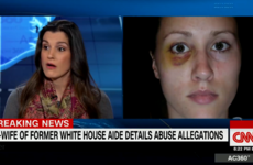 Donald Trump on ex-aide who allegedly beat his wife: 'We certainly wish him well'