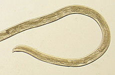 14 worms pulled from woman's eye after rare infection
