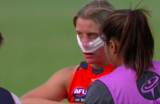 Cora Staunton soldiers on despite suffering nasty blow to the nose in Aussie Rules win
