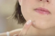 Beauty Q: Do you use Sudocrem on your spots?