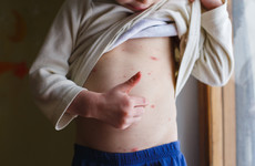 Poll: Do you know the warning signs of meningitis?