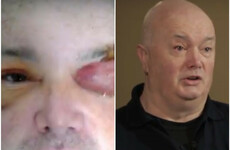 'The fact you can't see is terrifying' - Garda recounts being pelted by rocks while responding to callout