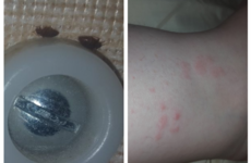 'It was filthy, absolutely filthy': Homeless family 'bitten by bed bugs' in hotel room
