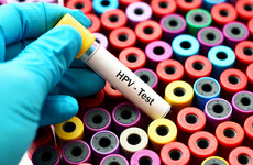 Explainer: Here's what you need to know about the new HPV test for cervical cancer