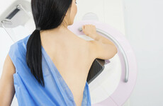 English breast screening scandal: Up to 270 women may have had lives shortened over IT error