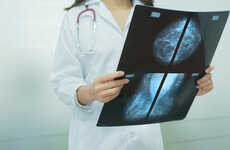 FactCheck: Does abortion increase the risk of a woman developing breast cancer?