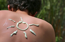 Poll: Will you be wearing suncream this weekend?