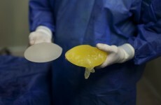 State 'should pay to remove PIP implants'