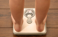 Study shows overweight people twice as likely to survive when hospitalised for infectious disease