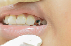 Poll: Would graphic photos on cans stop you from buying sugary drinks?