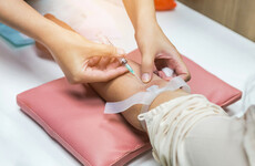 Irish people more prone to iron overload than European neighbours because of inter-marriage