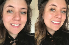 So, here's what happened when I got clip-in veneers