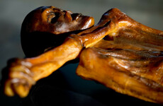 What did the Iceman of the Alps eat for his last meal? Goat bacon
