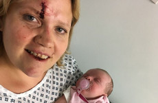 Mother run over by her own vehicle pleads for help catching men who fled with her baby daughter