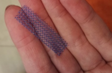 Ireland to pause use of transvaginal mesh after 'understandable public anxiety'