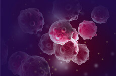 Irish scientists discover new treatment to help prevent relapse of aggressive form of breast cancer