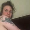 Lena Dunham shared intimate photos to mark the anniversary of her hysterectomy