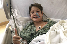 Miraculous recovery for 10-year-old US boy after meat skewer pierces skull