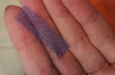 Reports made of controversial laser treatments being offered in place of vaginal mesh devices
