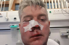 Referee who was assaulted at football game says he forgives those who attacked him