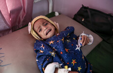 'Some are too frail to cry': Up to 85,000 children under five have died since start of 2015 Yemen war