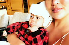 Here's why Chrissy Teigen's son Miles will be wearing a helmet for the next while