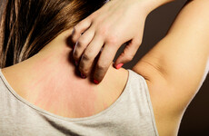 Researches reveal how the brain tells you to scratch an itch