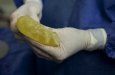 Chief Medical Officer to update Health Committee on PIP implants response