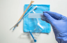 HSE confirms further 1,000 smear retests needed after samples expired due to backlog