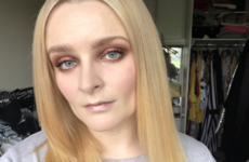 Skin Deep: Why do you have dark circles and how can you actually cover them?