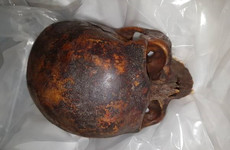 Man (35) charged over theft of 800 year-old mummified 'Crusader' head from Dublin church