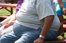 Developing world facing ‘obesity epidemic’, says major report