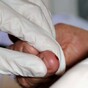 US government calls for 'baby boomer' hepatitis C testing