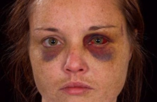 'I just accepted that this was how it was going to end': Victim of domestic abuse recalls horror attack