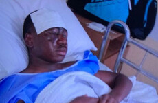 'He was in so much pain': Teenager moved to Cork hospital for treatment after chemical attack