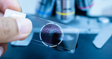 Deciphex wants to reduce pathologists' workload using artificial intelligence
