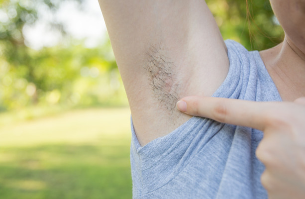 Opinion: Underarm hair is natural so why do people reel in horror from my  hairy armpits?